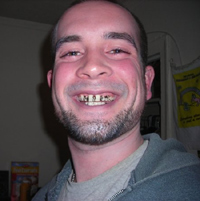 Casey with a gold grill on his teeth