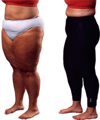 Leggings on a fat women