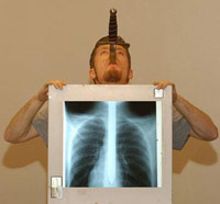 Man with sword down throat getting xray