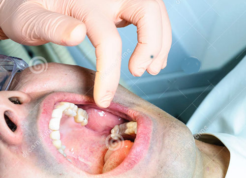 Dentist fingers in mouth