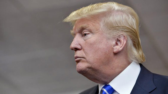 Donald Trump's bad hair secret