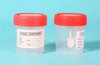 stool sample container